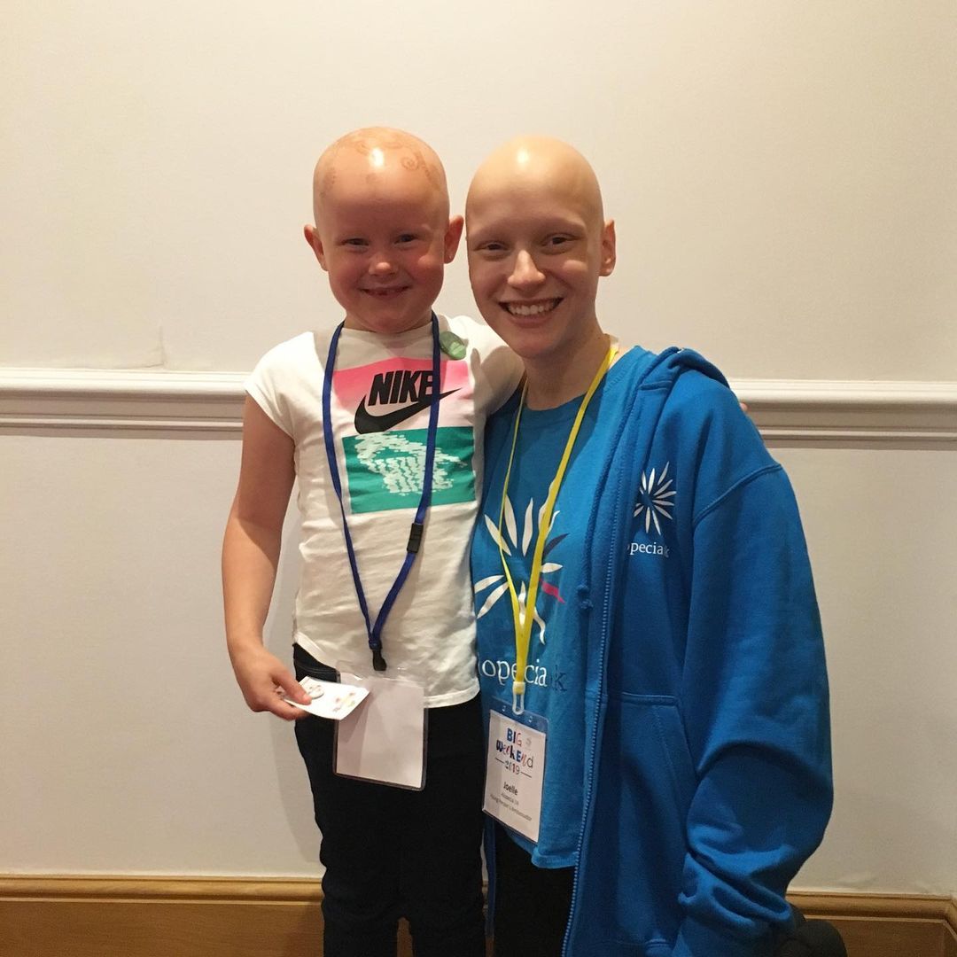 Alopecia UK Ambassador Joelle smiling next to a child with alopecia at an Alopecia UK event.